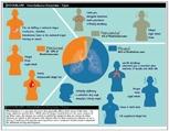 Pulse para ver la infografía de síntomas del mesotelioma