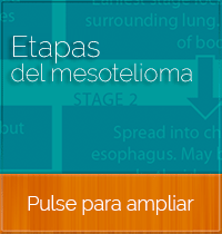 Etapas del mesotelioma