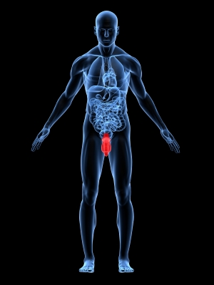 mesotelioma testicular